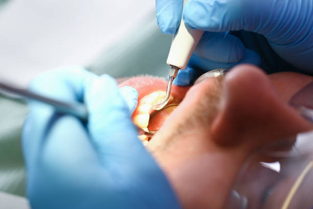 Best Pediatric Emergency Dentist in Lmyra, PA