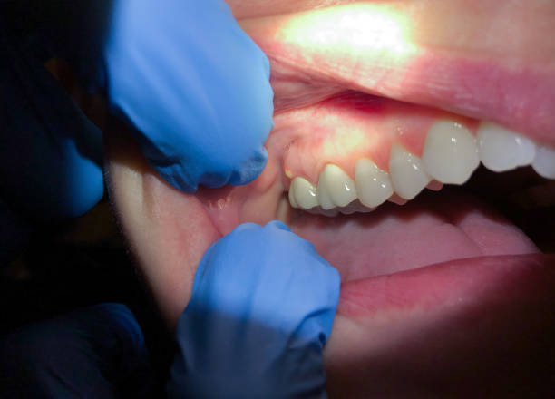 Best Emergency Orthodontic Repairs in Lmyra, PA